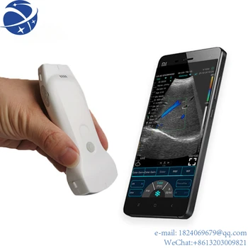 Yun YiUltrasound Sonda Bezdrôtový Vscan Porket Ultrazvuk Skener pre fyzikálne vyšetrenie